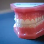 Is Invisalign Right For Me?