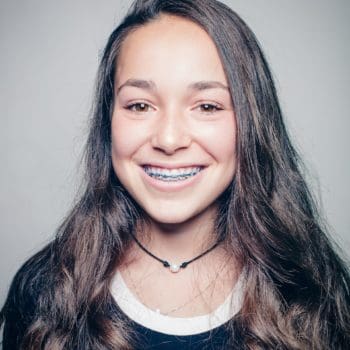 Appel Orthodontics Philadelphia Orthodontics Patient Portraits 31 350x350 - Philadelphia Braces & Invisalign